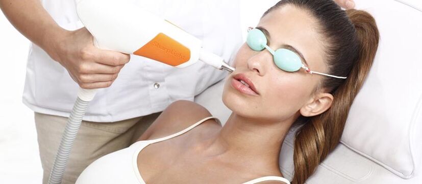 Rexurdimento da pel con láser