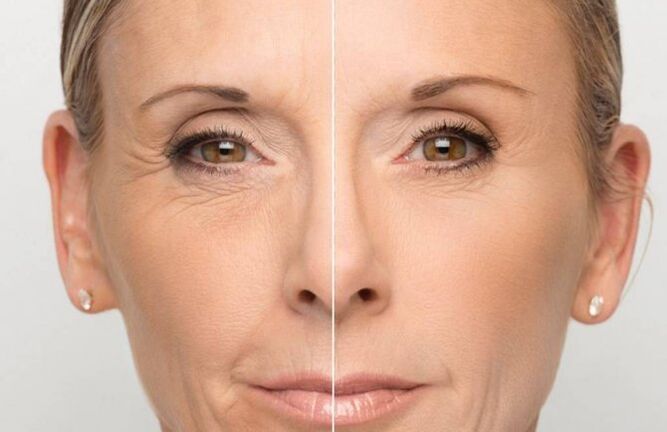Pel facial antes e despois do rexuvenecemento con máscaras