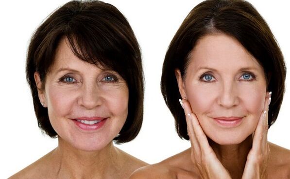 antes e despois do rexuvenecemento da pel facial na casa